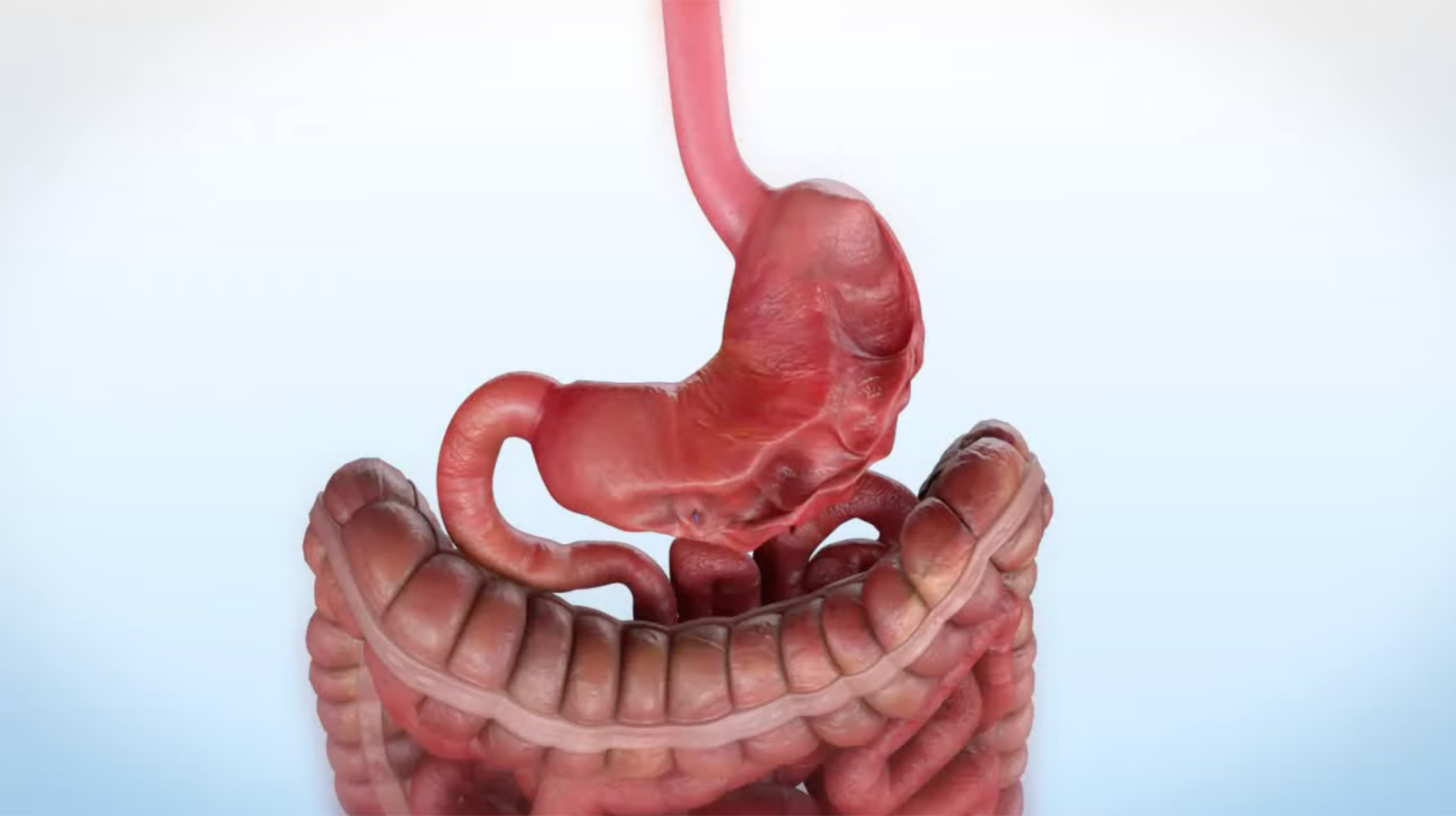 Endoscopic Sleeve Gastroplasty